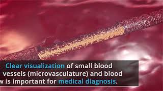 Ultrasound Monitoring of Microcirculation: An original study from the laboratory bench to the clinic