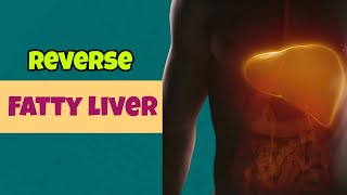 Strictly Avoid These 10 Foods If You Have Fatty Liver | Fatty Liver Treatment