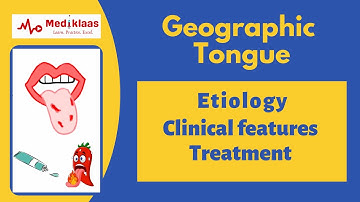Geographic tongue (Benign Migratory Glossitis)
