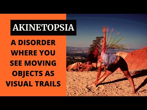 Akinetopsia - An Inability to see the motion of an object