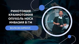 Ринотомия. Инвазия в мозг