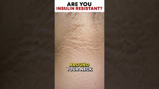 Are you Insulin Resistant? | SugarMD [Sugarmds.com] screenshot 1