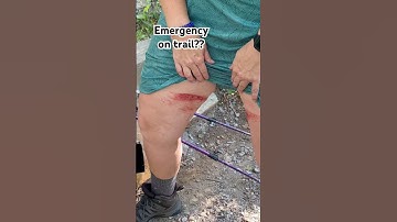 Appalachian Trail VA Emergency on trail? #nature #adventure #appalachiantrail #ems #hiking
