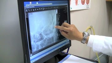 How to prevent hearing loss