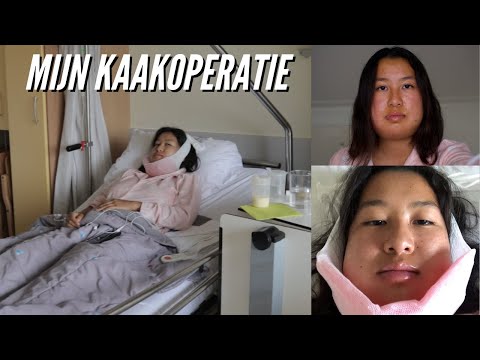 Mijn Kaakoperatie + 1 Week Herstel Erna 🏥 (Deel 1/2)