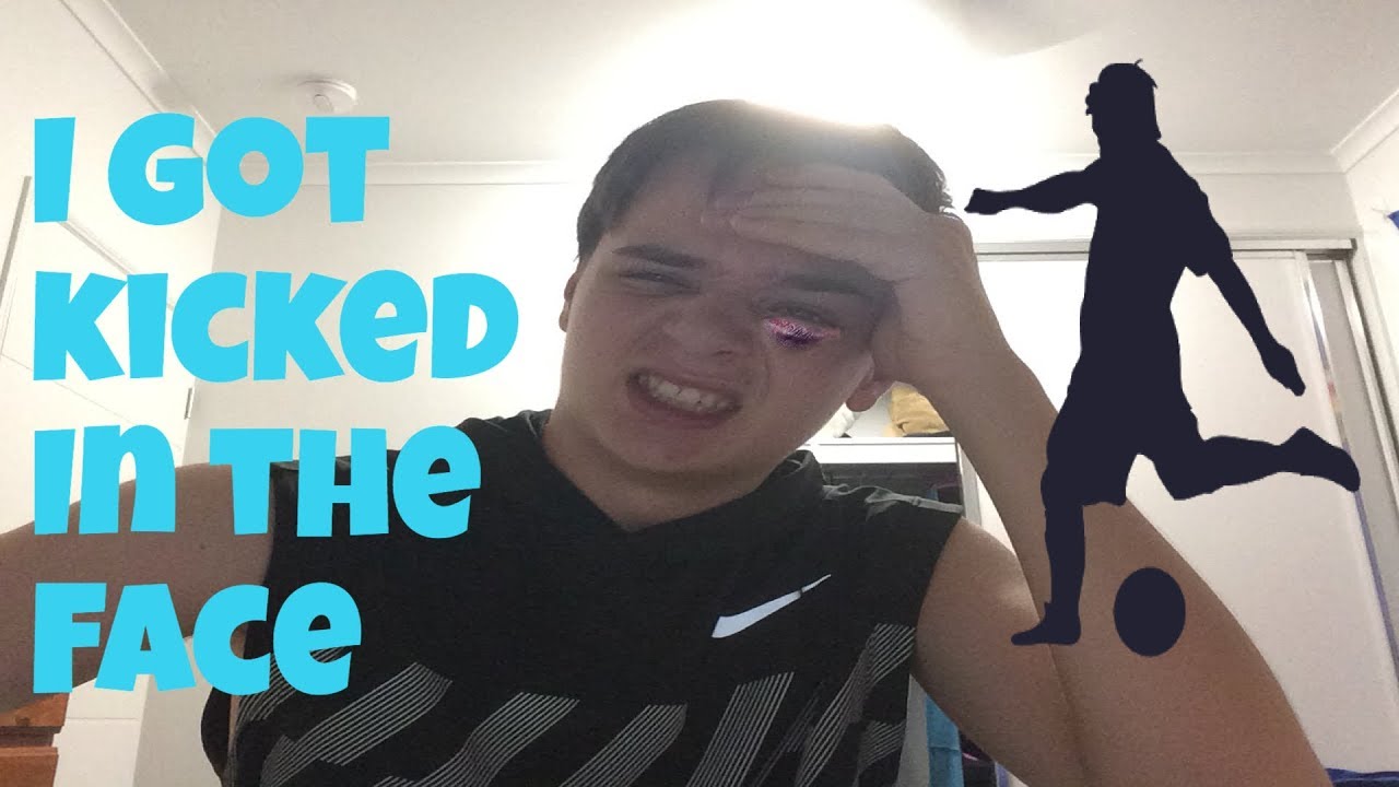 I got kicked in the face while playing soccer YouTube