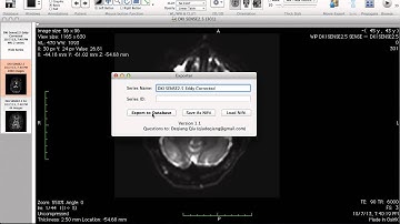Exporter (Osirix Plugin) Demo