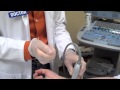 Radial Artery Access using Ultrasound