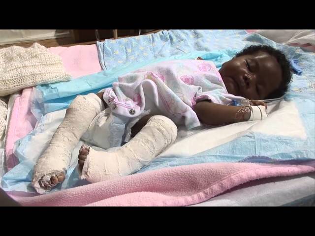 Unbreakable: A Story of Hope and Healing in Haiti - YouTube
