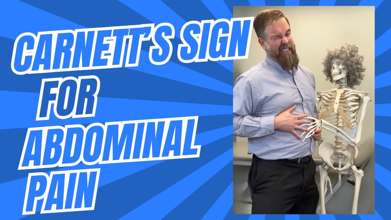 Carnett's Sign for Abdominal Pain - YouTube