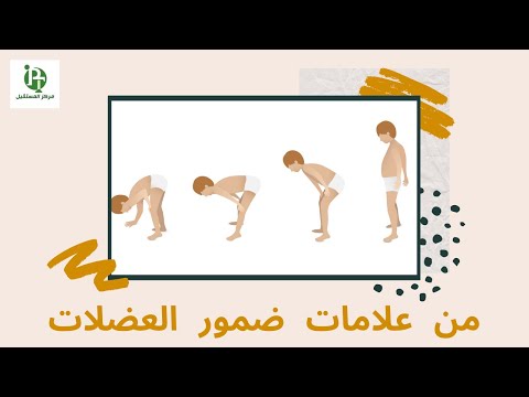 من علامات ضمور العضلات    