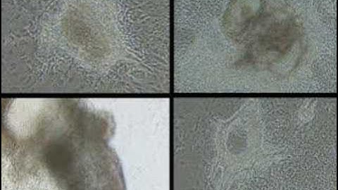 Understanding Embryonic Stem Cells Part 6 of 6