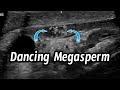 Dancing megasperm