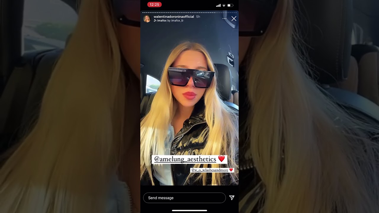 JILL von ARE YOU THE ONE beim Beauty Doc mit Walentina YouTube