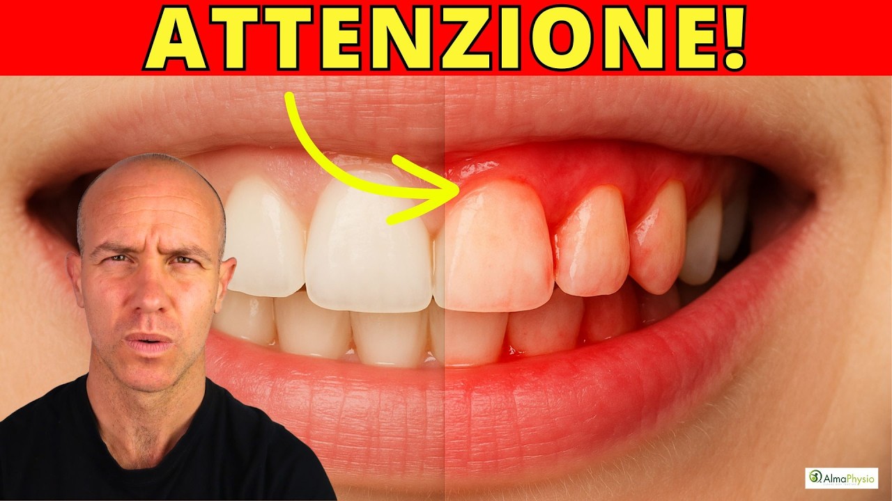 Il segnale che NON devi ignorare: gengive che sanguinano 🩸