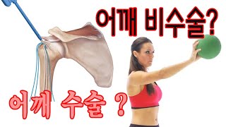 어께 수술을 한 경우와 하지 않는 경우 무슨 차이가 있을까?