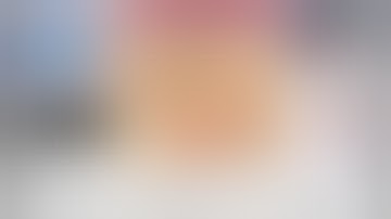 Simplifying STA-MCA Bypass Surgery