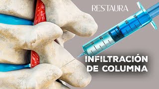 Infiltración De Columna Qué Es? Qué Se Inyecta? Cuánto Dura El Efecto?