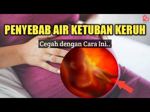 Video: Apa Penyebab &Ldquo; Pemanasan Global &Rdquo; Di Tata Surya? - Pandangan Alternatif