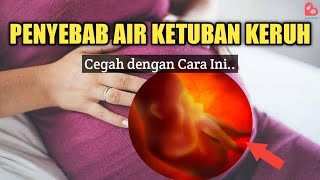 Air Ketuban Keruh Saat Hamil Tua, Apa Penyebab dan Bahayanya?
