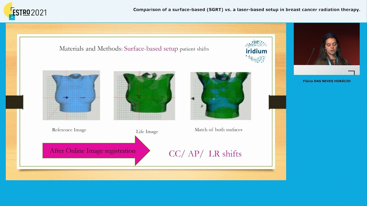 Comparison of a surface based SGRT vs laser based setup in breast cancer using Catalyst HD (C-RAD)