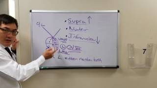 Supranuclear control of cranial nerves