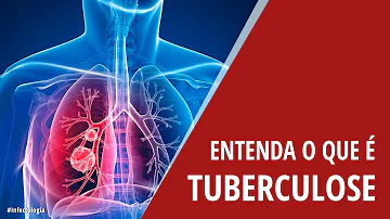 Quais são as complicações da tuberculose?