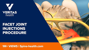 Facet Joint Injections Procedure