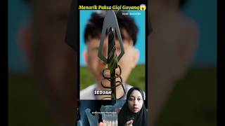 Menarik Paksa Gigi Goyang😱 #faktamenarik #faktaunik #faktadunia #gigi #faktailmiah #fypreels #viral