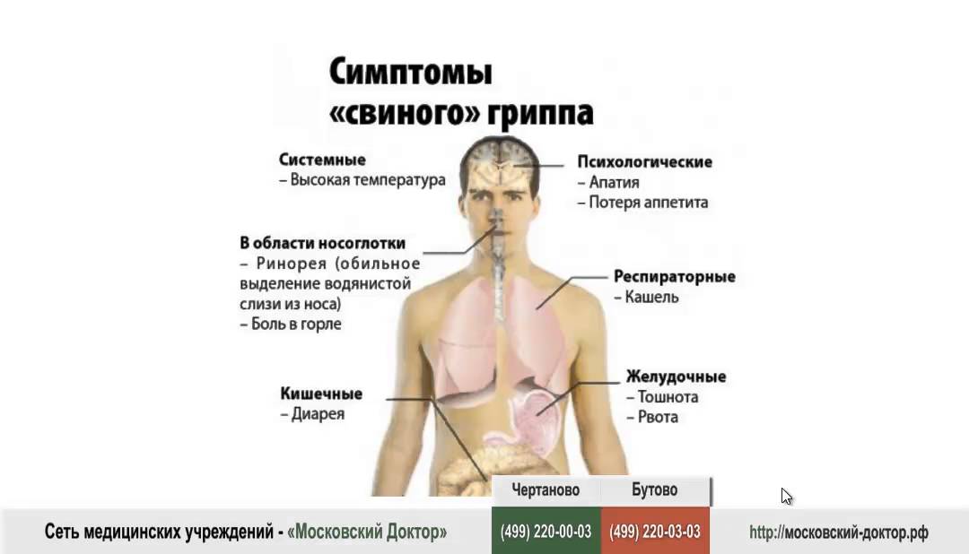 Какие признаки свиного гриппа. Свиной грипп. Свинячий грипп симптомы. Свиной грипп н1n1 симптомы. 1 симптомы свиного гриппа.