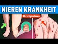 4 akute Anzeichen und Symptome einer Nierenerkrankung!