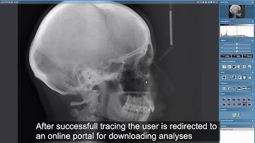 Planmeca Romexis automatic cephalometric analysis service