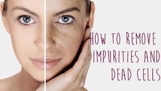 Impurities