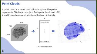 Point Cloud based NN for 3D FCD segmentation on MRI