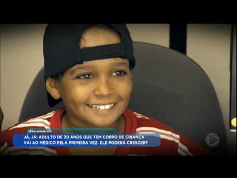 Vídeo: Um Menino De 13 Anos Parece Uma Criança De 3 Anos - Visão Alternativa
