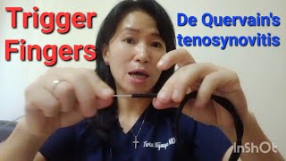 De Quervains Tenosynovitis  Trigger Fingers  Dr Tirtawati Wijaya Se