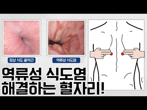 매스틱