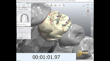 Fast 3 Minute Crown Design with 3Shape