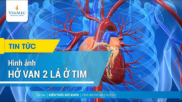 Hình ảnh hở van 2 lá ở tim