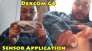 Dexcom G6 Sensor Application and tips (2022)