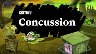 Concussion:In-depth Guide to Traumatic Brain Injury (Full Lesson)| Sketchy Medical | USMLE Step 2 CK