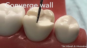 Complex Amalgam Prep - Dr.Hind Hussein