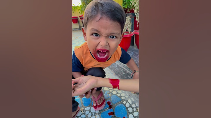 Lucky ban gaya vampire 😳🧑🏼‍🦰 #trending #ytshorts #viralvideos #shorts