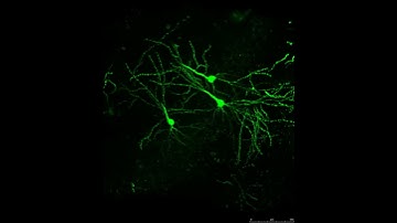 Mouse Brain Sections - 276 Micron - 3 D