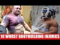 Top 10 Worst Bodybuilding Injuries Ever