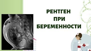 Рентген при беременности!!!! Можезо ли рентген при беременности?Когда и зачем назначают рентген! Рентген при беременности!!!! Можезо ли рентген при беременности?Когда и зачем назначают рентген!