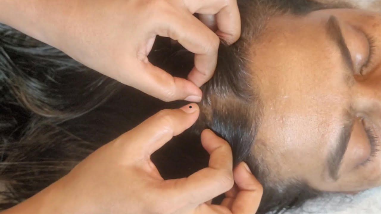 ASMR Scalp Check (Extreme Tingles & Sleep Guaranteed)