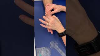 Thumb: MCP flexion ROM