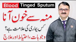 Blood Tinged Sputum - Moun se khoon ana | Khoon Thukna | Causes By Dr. Tariq Ali Sheikh