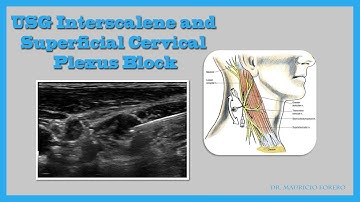 USG Interscalene and Superficial Cervical Plexus Block